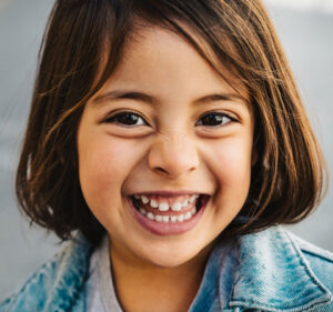 cleft lip model smiling