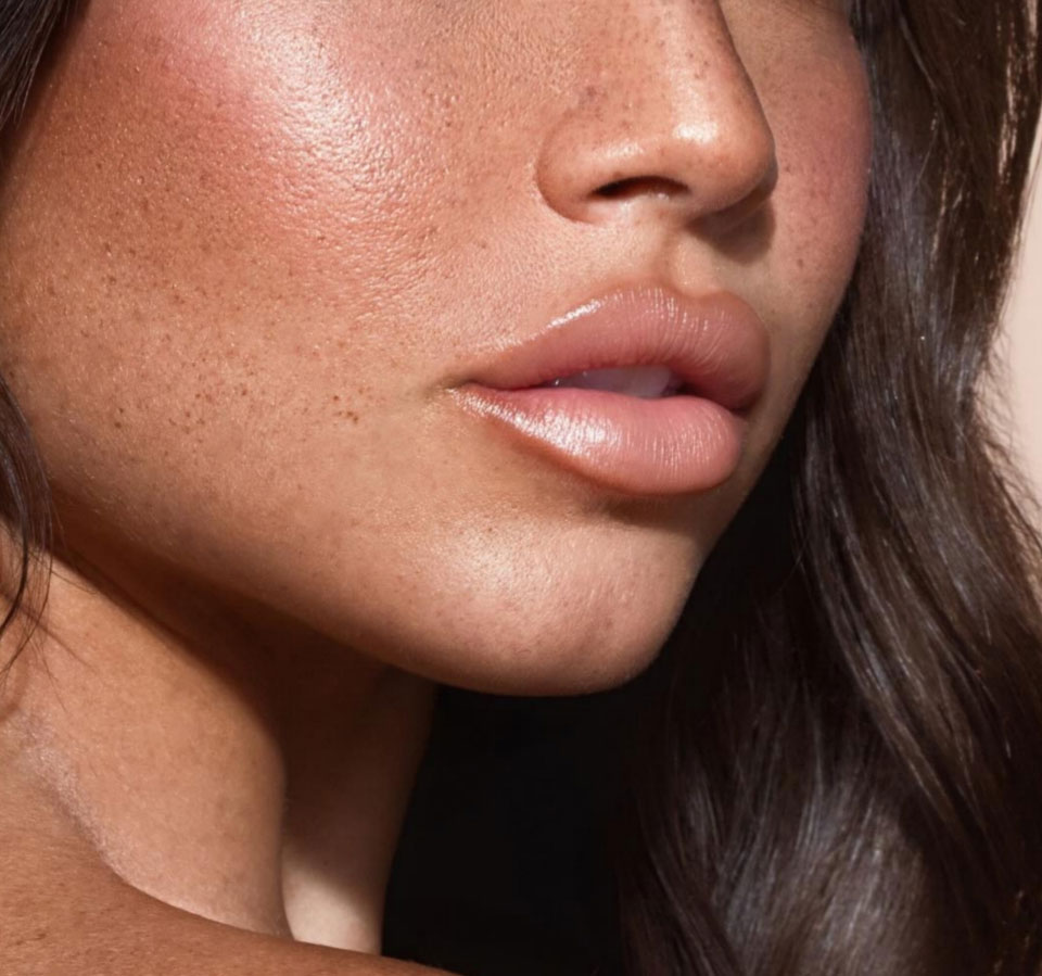 lip rejuvenation model